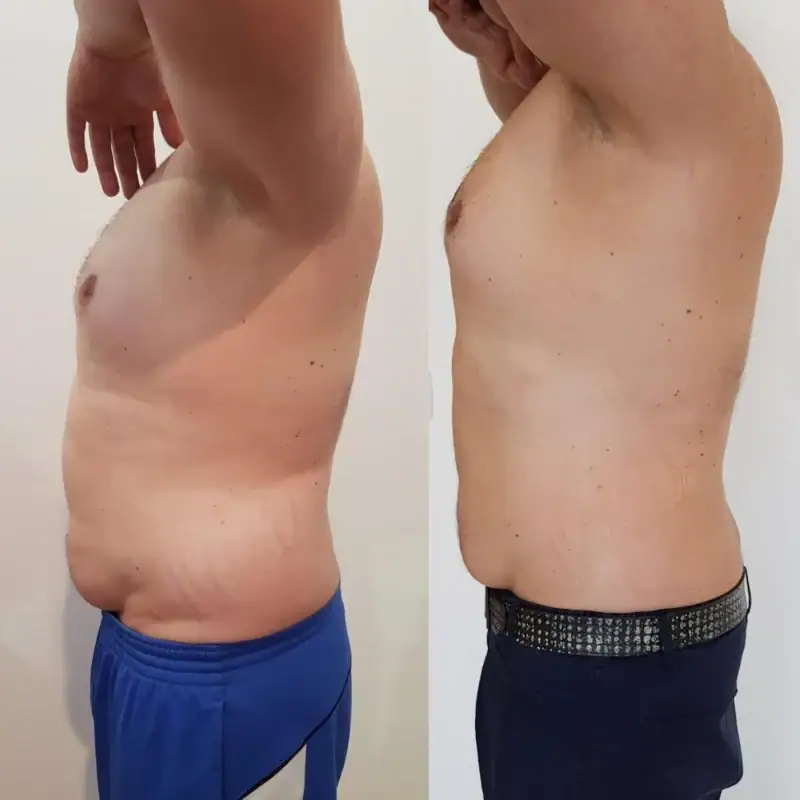 Side-by-side comparison of a man's body showing significant weight loss and improved muscle tone after fitness journey.